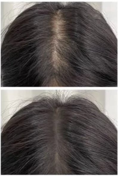 Customer photo review of My-Glamora Haarvuller Poeder – Direct een vollere haarlijn