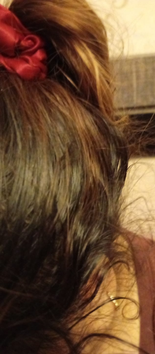 Customer photo review of Anagrow Rosemary Hair Oil