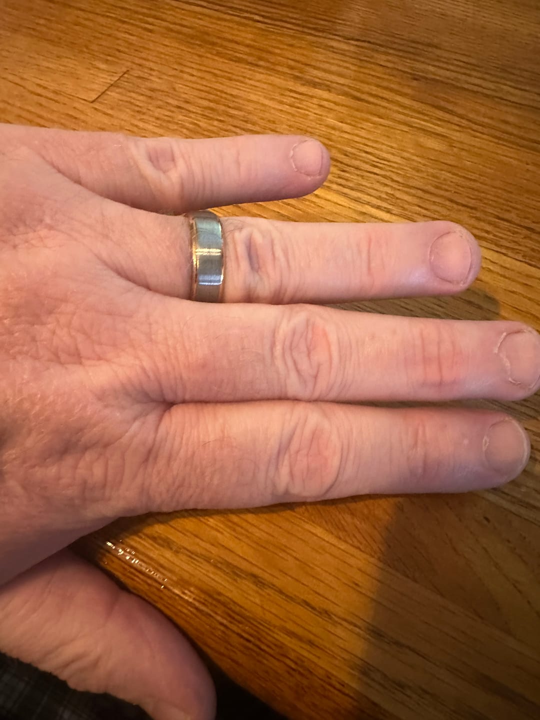 Customer photo review of Thorum Ring Sizer