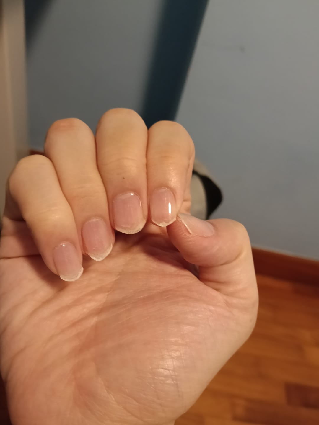 Customer photo review of Crystal Clear DIY Semicured Gel Nail Sticker Kit (STOP NAIL BITING & GROW BRITTLE NAILS)