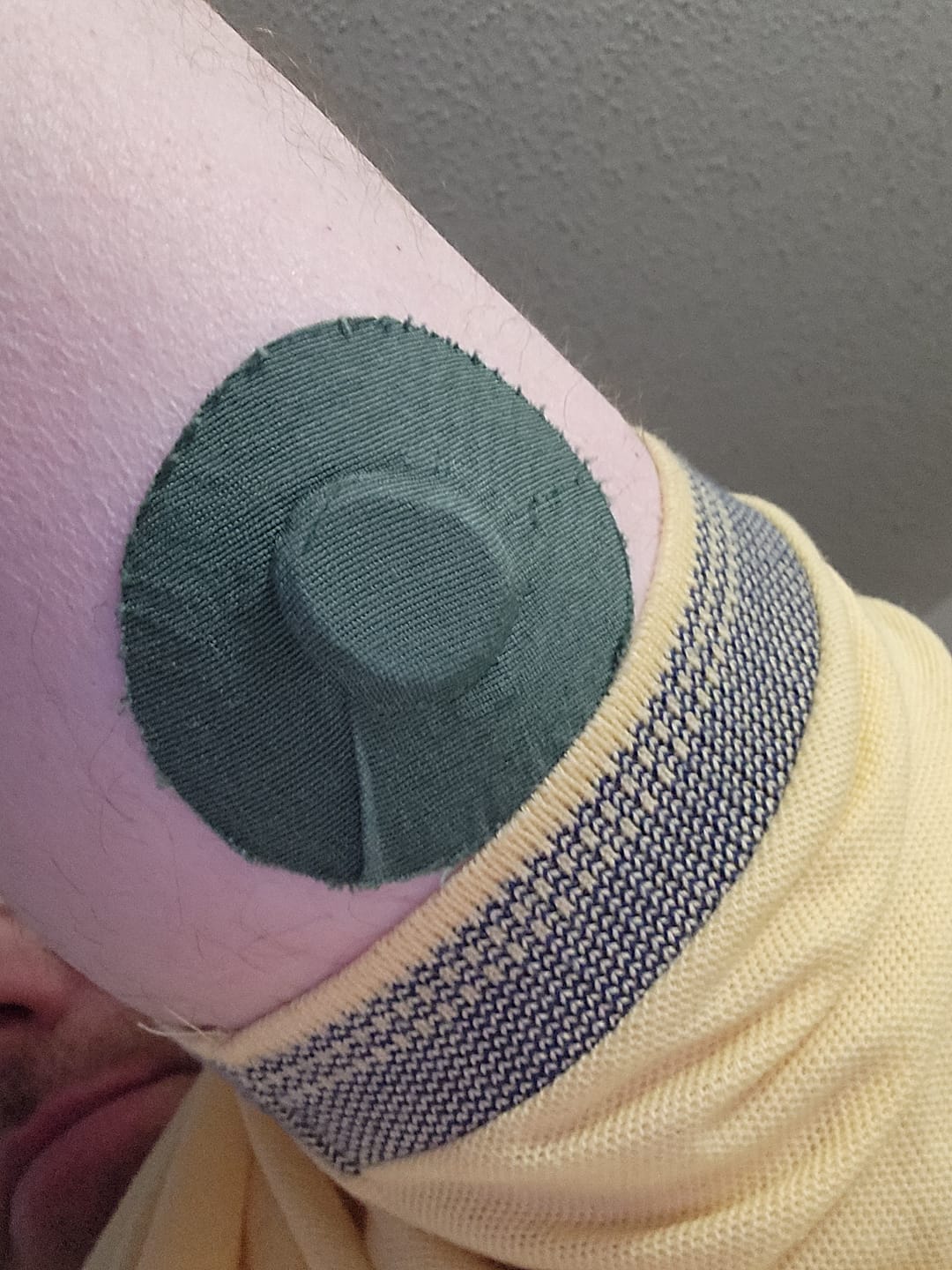 Customer photo review of Skin Grip Original - Dexcom G7 & Stelo Adhesive Patches