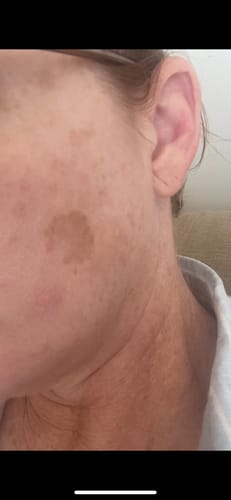 Customer photo review of BEAUTY SUPER STICK + MAGNESIUM SPRAY