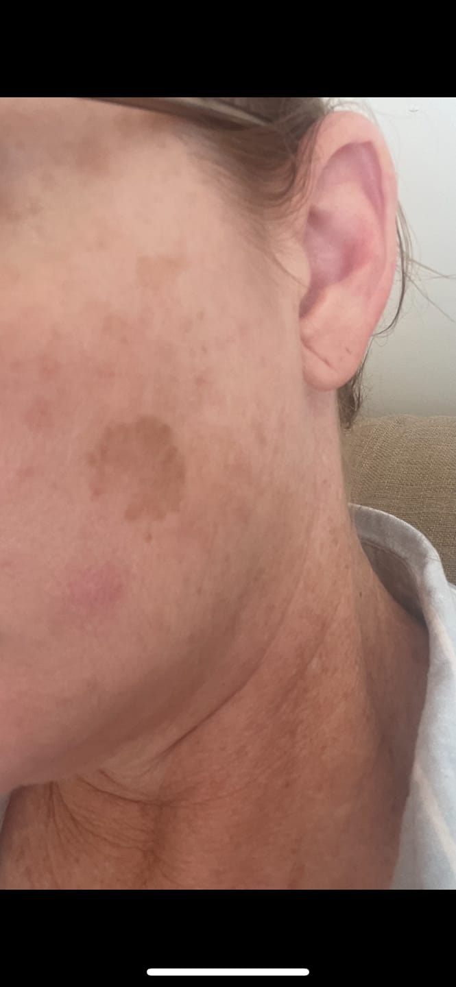 Customer photo review of BEAUTY SUPER STICK + MAGNESIUM SPRAY