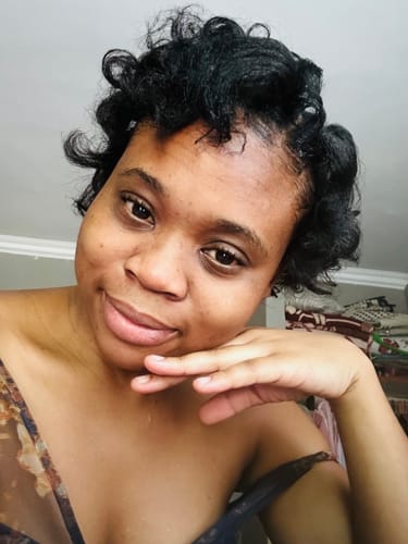 Customer photo review of Minoxidil 5% Solution, 1 Pack 60ml