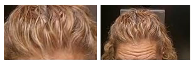Customer photo review of My-Glamora Haarvuller Poeder – Direct een vollere haarlijn