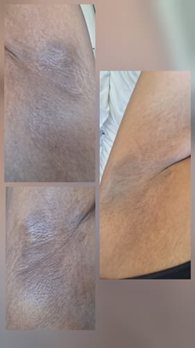 Customer photo review of Glow Getter