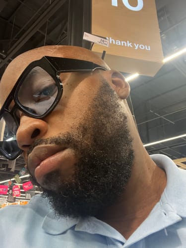 Customer photo review of Minoxidil High Strength (5%) FOAM, 3x60ml pack