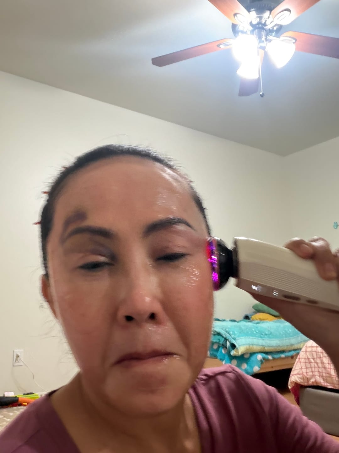 Customer photo review of INIA FLARE Microcurrent Facial Device