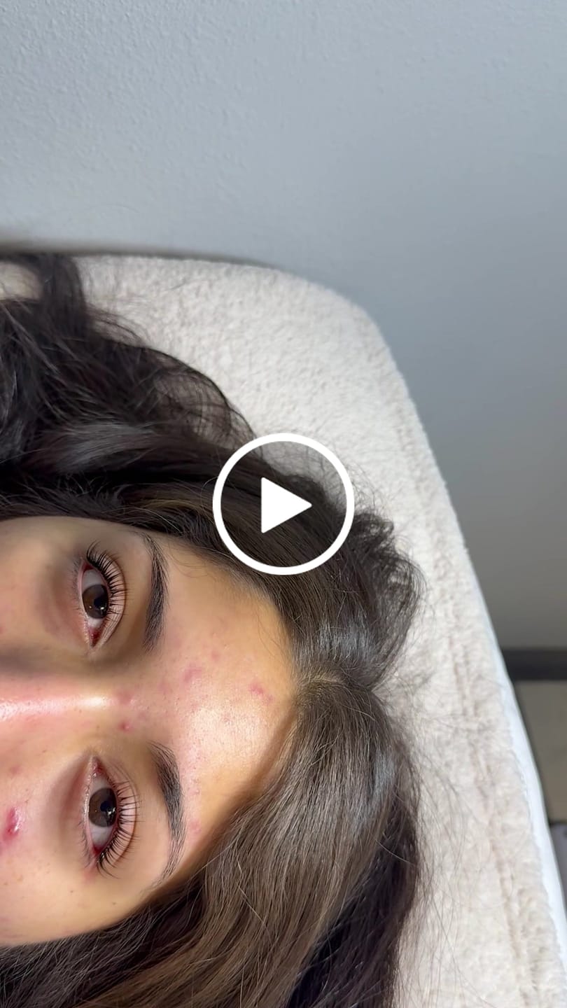 Customer video review of BOO- Pure Care Lash & Brow Lift Pack