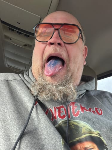 Reviewer showing their tongue stained a bright blue after taking Meraki Blu Methylene Blue.