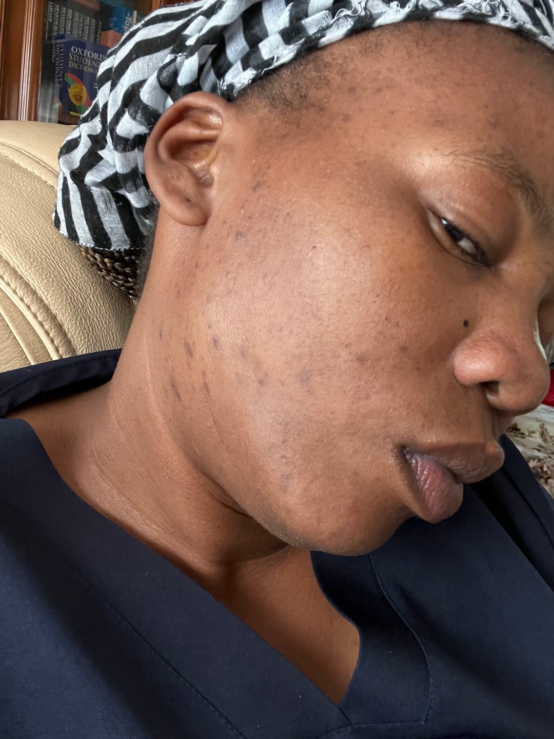 Customer photo review of Gmaeum Clear Complexion Set