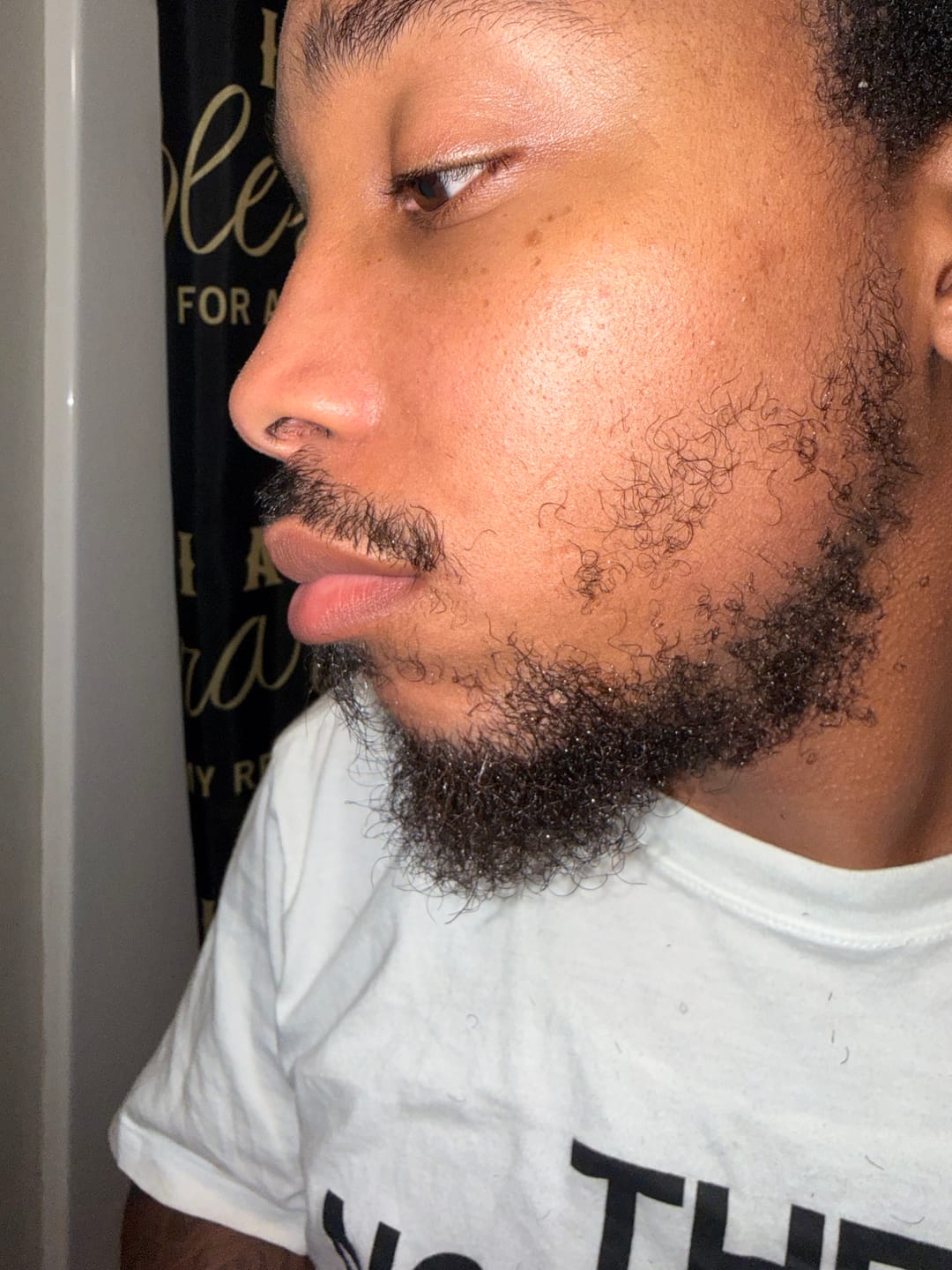 Customer photo review of Men’s Healthy Hair and Beard Starter Kit