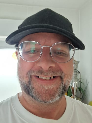 Customer photo review of Faccette-Dentali 3.0