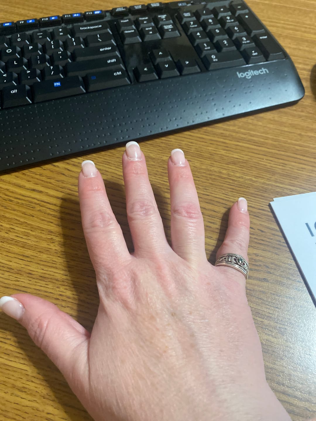 Customer photo review of Chrysoprase Classic
