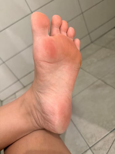 Customer photo review of Baren - Kit adoucissant pour les pieds