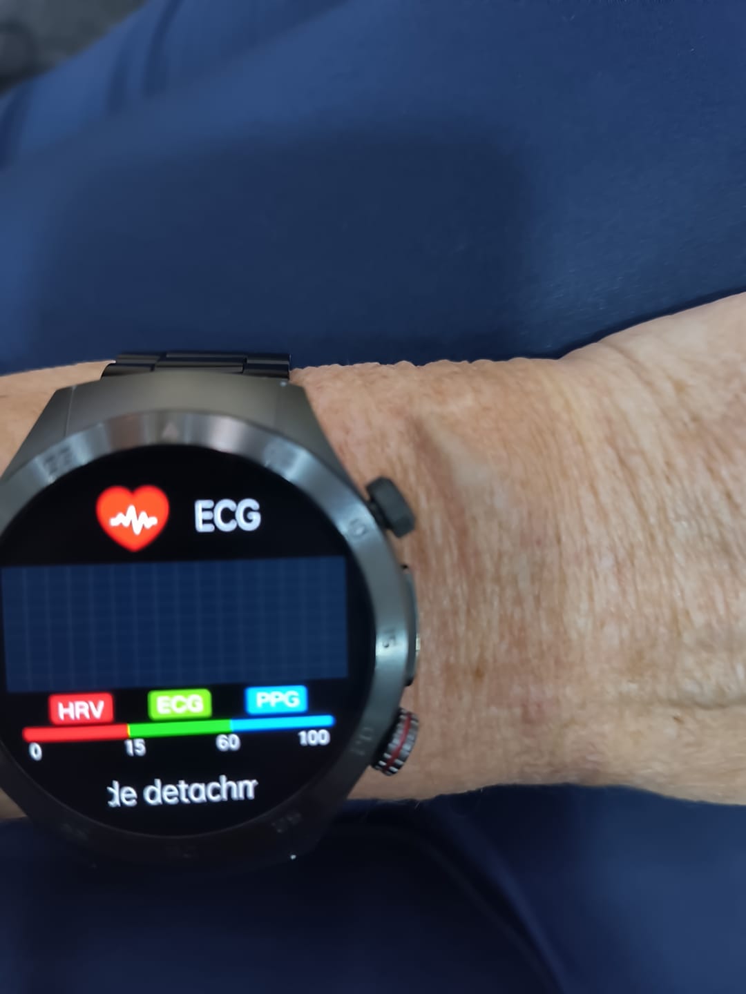 Customer photo review of Bearscome Laser therapy smart watch ecg blood glucose blood oxygen uric acid lipid monitoring