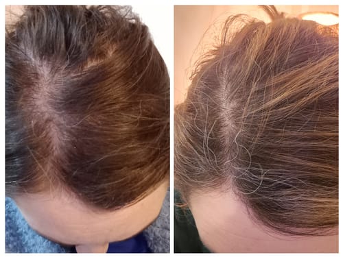 Customer photo review of VITAFOAM ™ Hair Growth Formula