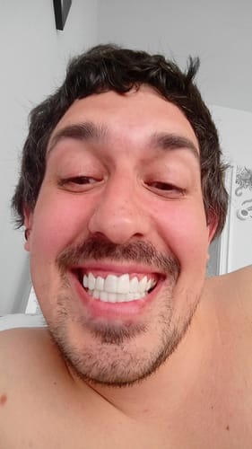 Customer photo review of Faccette-Dentali 3.0