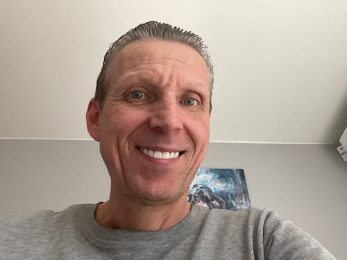 Customer photo review of Facette-Dentaire 3.0