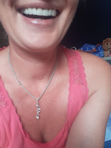 Customer photo review of Facette-Dentaire 3.0