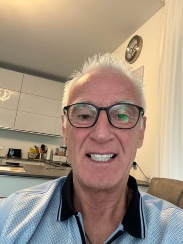 Customer photo review of Faccette-Dentali 3.0