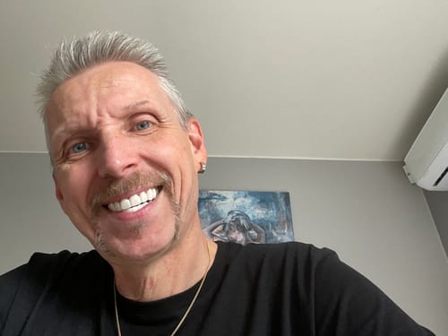 Customer photo review of Facette-Dentaire 3.0