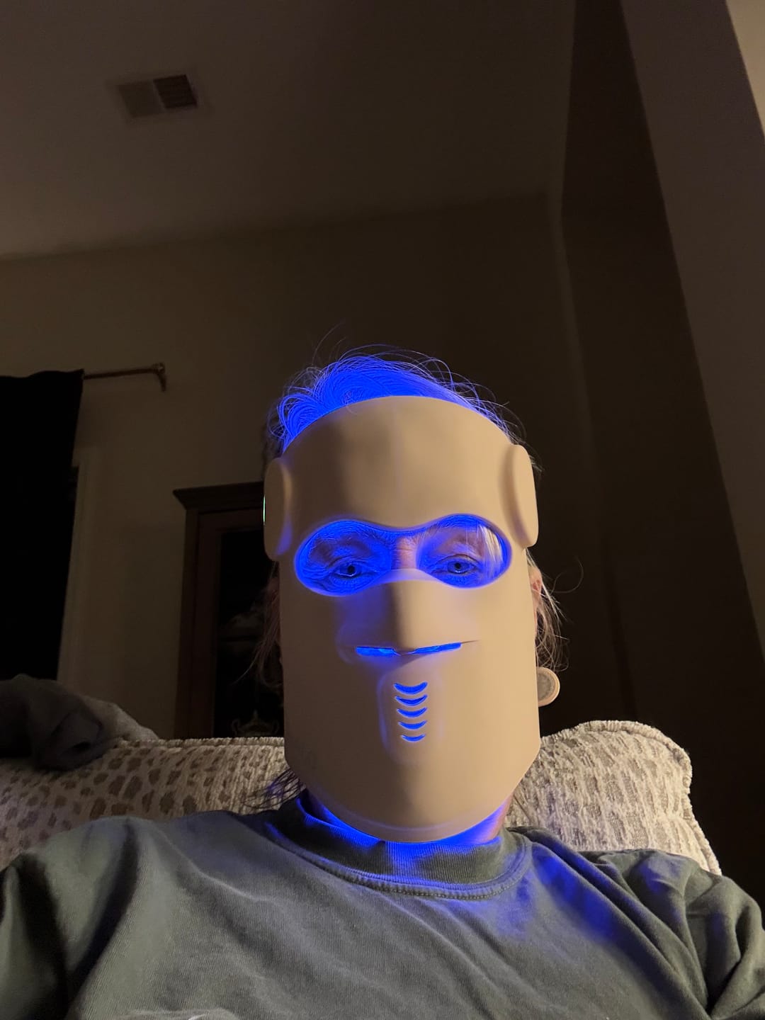 Customer photo review of Hatch Halo™ Dermatologist Grade 3-in-1 Light Therapy Mask