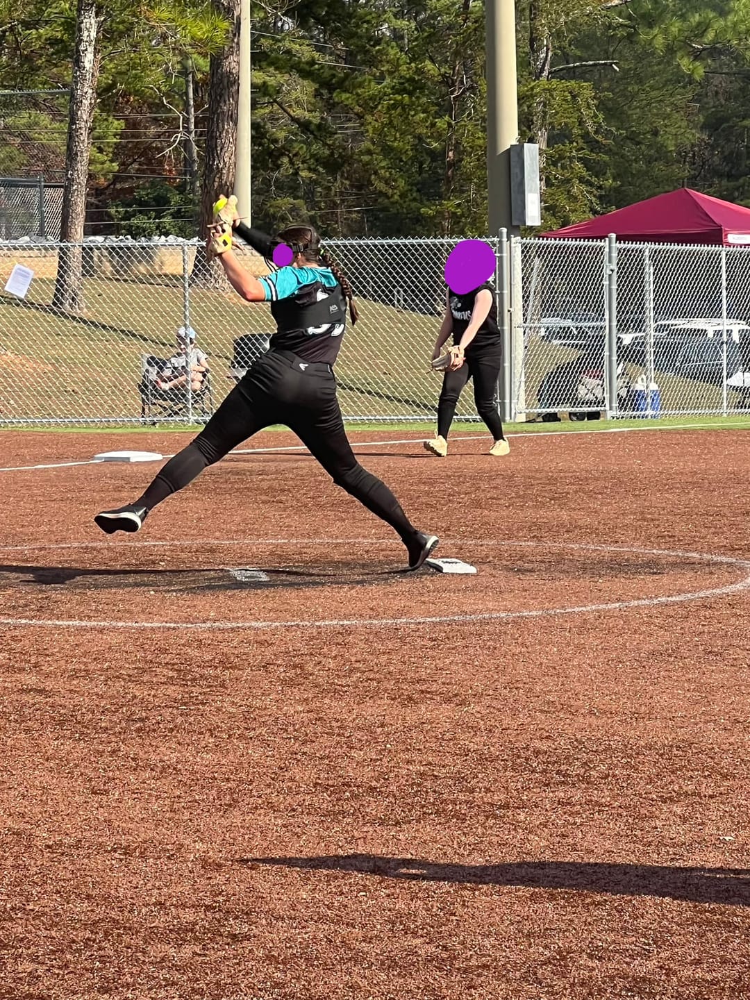 Customer photo review of Dynamic Shoulder & Elbow Stabilizer - K2 Adult Sleeve