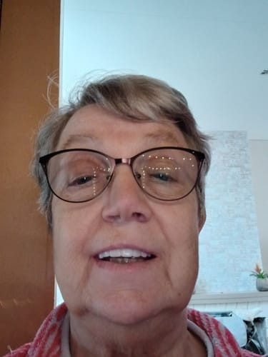 Customer photo review of Facette-Dentaire 3.0