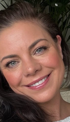 Customer photo review of Faccette-Dentali 3.0