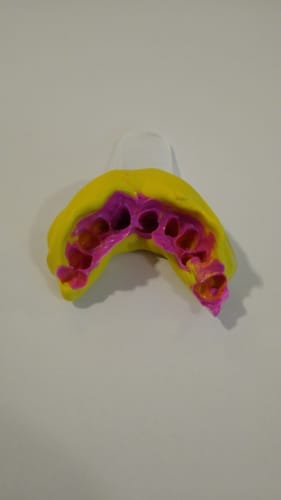 Customer photo review of Set di impronta