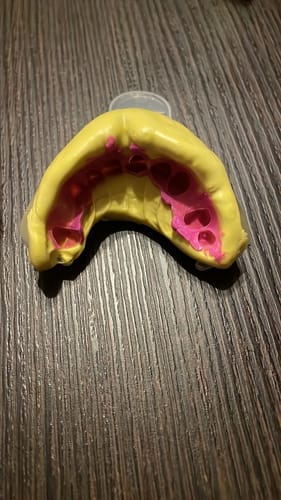 Customer photo review of Set di impronta