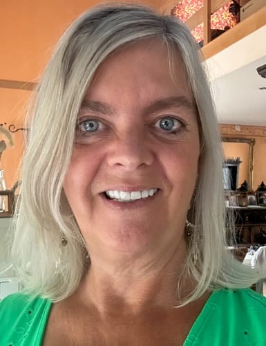 Customer photo review of Faccette-Dentali 3.0