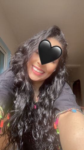 Customer photo review of Facette-Dentaire 3.0