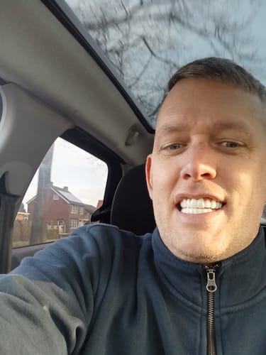 Customer photo review of Due denti aggiuntivi