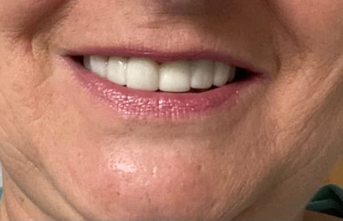 Customer photo review of Set di impronta