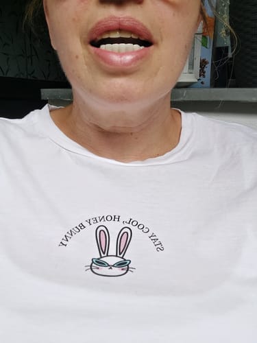 Customer photo review of Faccette-Dentali 3.0