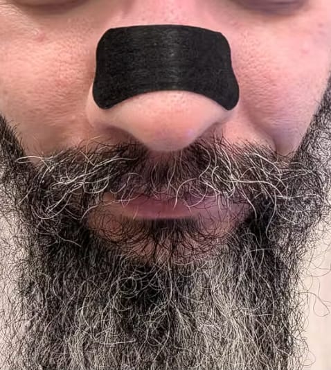 Customer photo review of Nasal Strips | For Better Breathing and Less Snoring