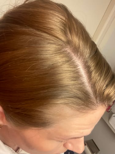 Customer photo review of Sunkissed Starter Kit