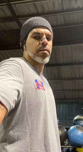 Customer photo review of Nasal Strips | For Better Breathing and Less Snoring