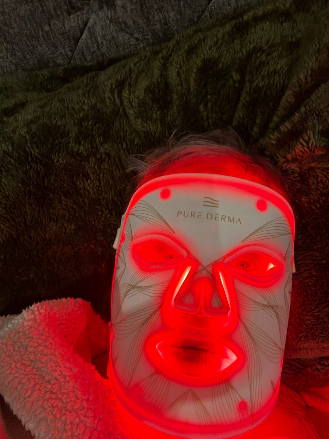 Customer photo review of LED Light Therapy Face, Neck & Décolletage Mask
