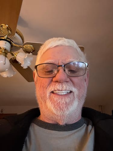 Close-up of a smiling reviewer with a white beard showing his bright teeth with Pop On Veneers.