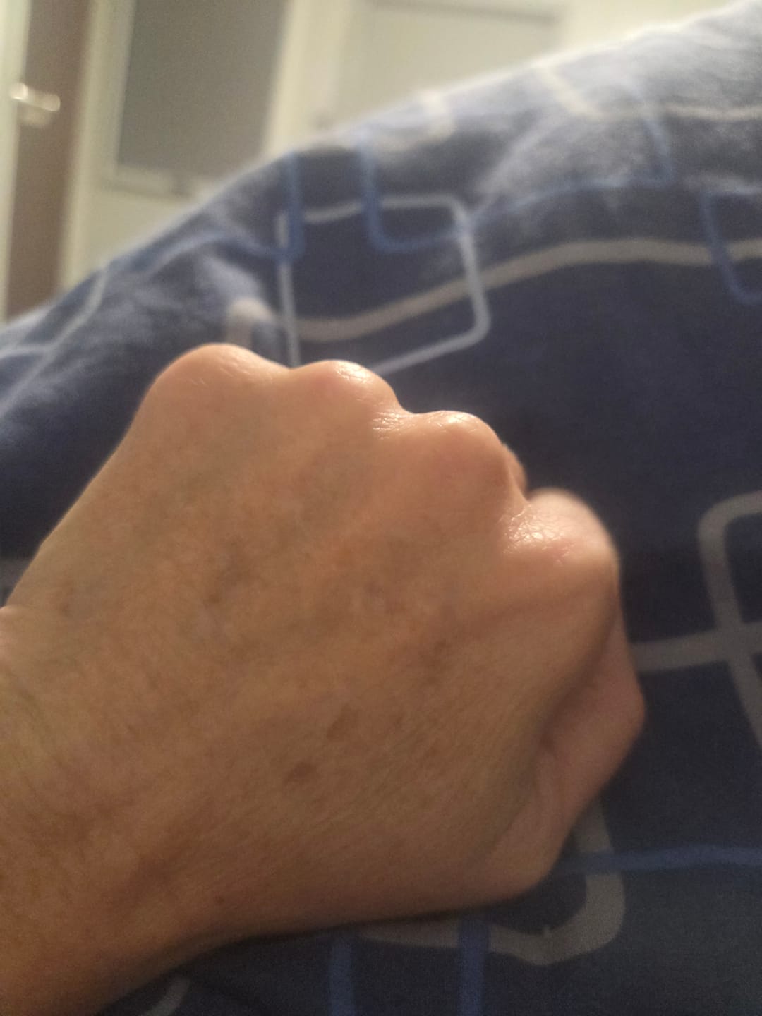Customer photo review of MAGNESIUM SUPER STICK