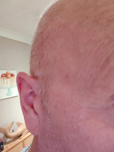 Customer photo review of Seb Natural Soothing Balm