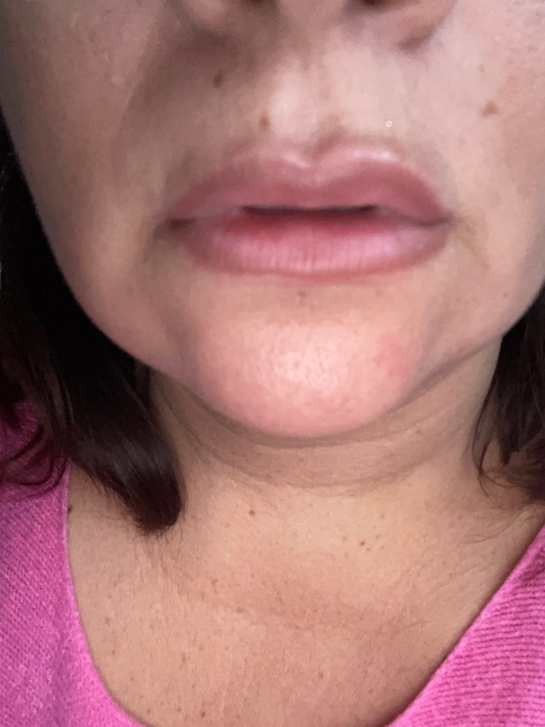 Customer photo review of Lip Contour