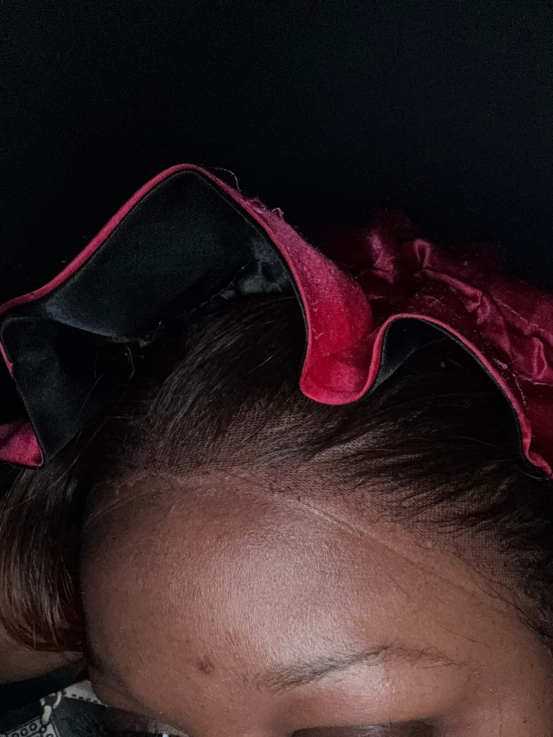 Customer photo review of Lace Tapes