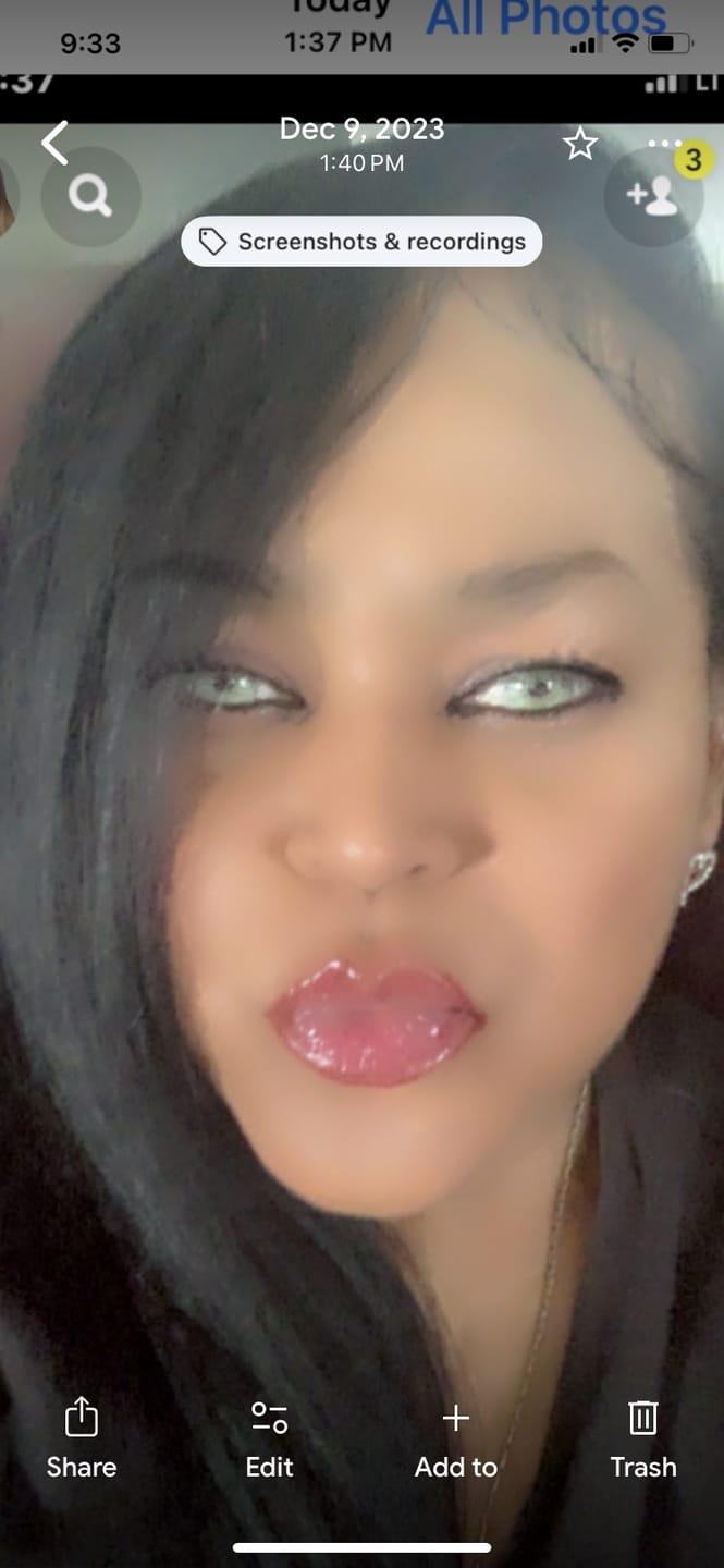 Customer photo review of Clover Green Prescription Colored Contact Lenses
