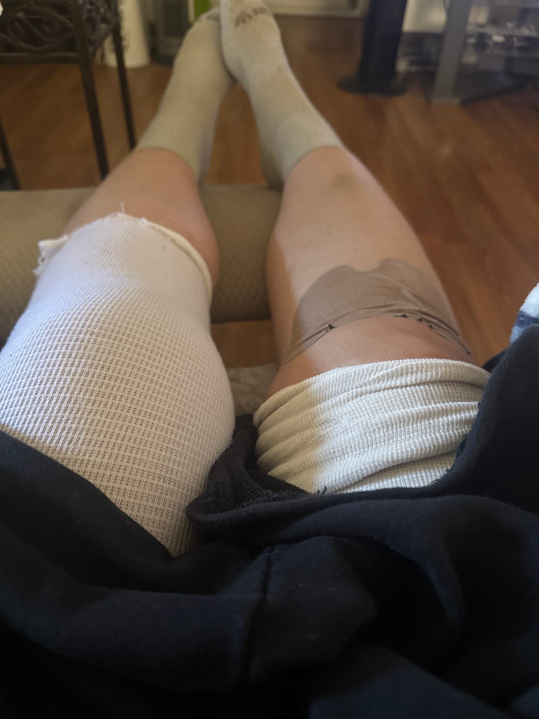 Customer photo review of Auxilium Knee Patch (fka Heaven Patch)