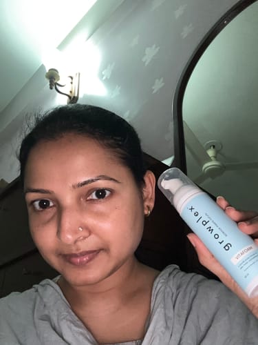 Customer photo review of VITAFOAM ™ Hair Growth Formula