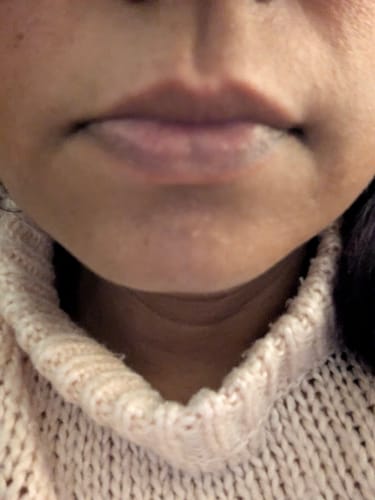 Customer photo review of Plump & Go Pen